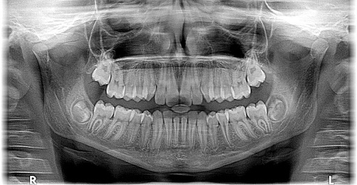 OPERADOR RAYOS X DE DIAGNÓSTICO DENTAL O PODOLÓGICO (-) (40 horas)