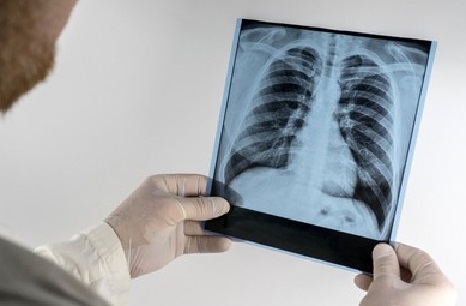 INTRODUCCION A LA RADIOLOGIA CLINICA (20 horas) (Tenerife)